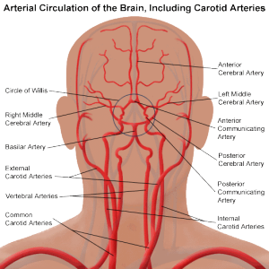 Arterial circulation of the brain including the carotid arteries