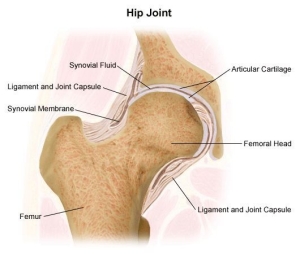  An illustration of a hip fracture.