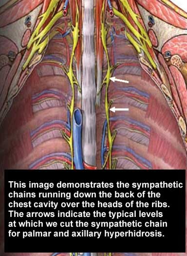 diagram of sympathetic chains in the chest cavity